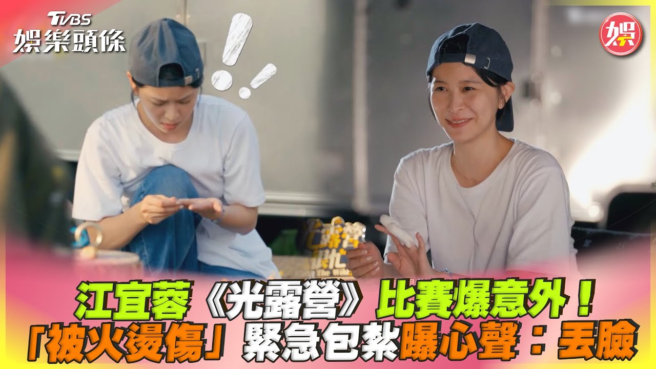 《光露營》比賽爆插曲!江宜蓉燙傷急救 懊惱自責:太笨了
