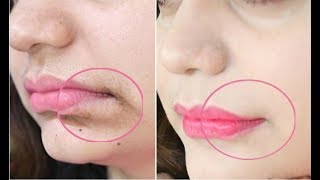 This 1-Minute Technique will Remove Mouth Wrinkles & Lift Corners Of Your Mouth Instantly