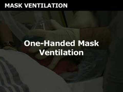 Mask Ventilation (sample) - www.proceduresconsult.com