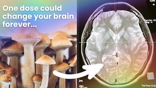 Download lagu How Scientists Believe Psilocybin Rewires the Brain mp3