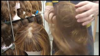 תיקון סקין של פאות ותוספות שיער כיפה פדחת