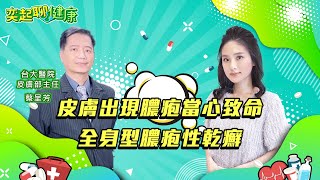 皮膚出現膿疱當心致命 全身型膿疱性乾癬