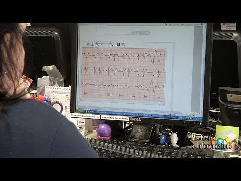 Fibrillazione atriale  e anticoagulanti orali per ridurre il rischio cardioembolico