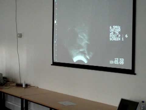 Maad Skillz in Fife Ultrasound - Psylent V