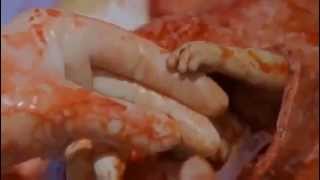 EMBRYO shakes hands during abortion