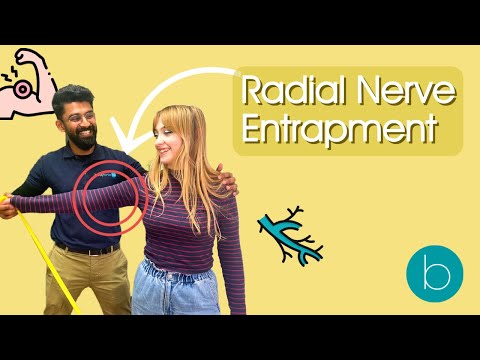 The Ultimate Guide to Radial Nerve Entrapment