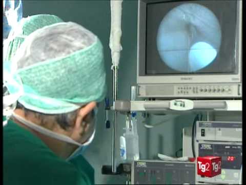 Candele da propoli miele da prostatite Trattamento del carcinoma prostatico grado 3