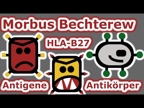 Morbus Bechterew und HLA-B27 erklärt -  Autoimmunerkrankungen woher kommen sie?