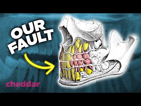 The Surprising Reason Why Human Teeth Are A Design Disaster - Cheddar Explains