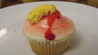 YouTube's Best Cysts!  Infected Cyst, Cyst Cupcakes!