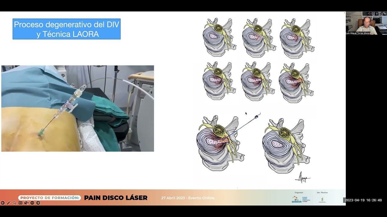 Luis Miguel Torres Morera-7