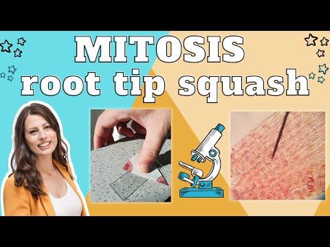 Mitosis root tip squash - Required practical A level Biology. Method explained & exam questions