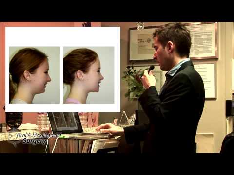 Orthognathic Surgery. Dr. Alexander V.Antipov, D.D.S. - YouTube