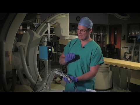 Using the Sterile Sleeve for Shockwave IVL in the United States