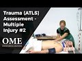 Trauma Assessment Multiple Injuries Part 2