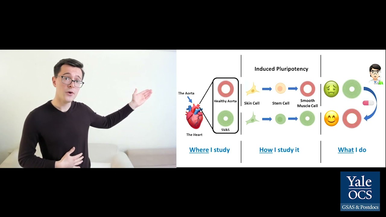 3-Minute Thesis Competition (2021) First-Place Winner Matthew Ellis