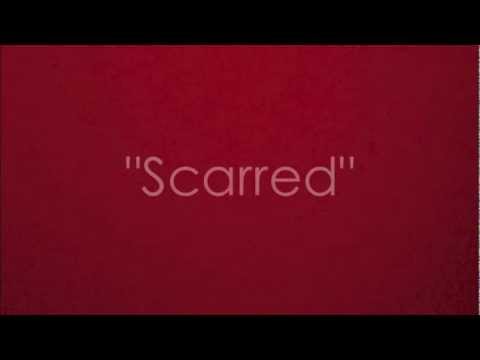 Scarred - Jamestown Story