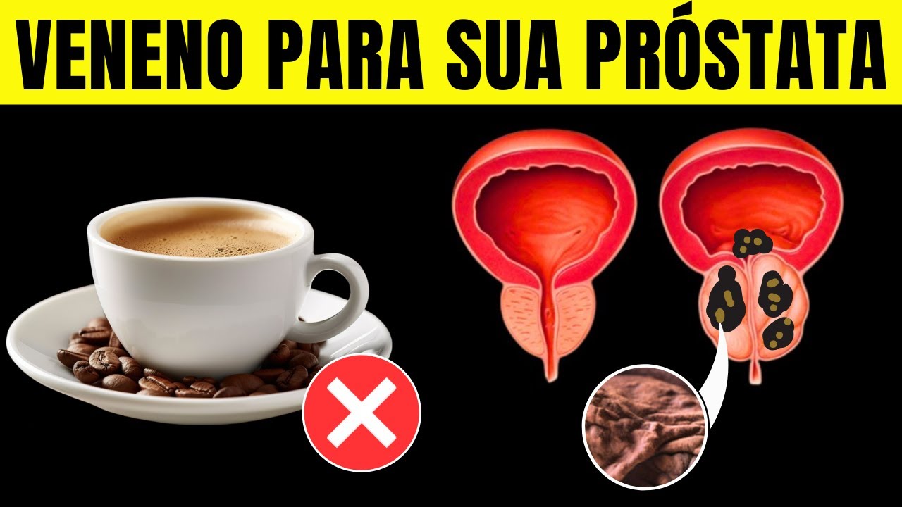 SUA PRÓSTATA É REDUZIDA EM 57% SE VOCÊ PARAR DE COMER ESTES 9 ALIMENTOS | CORPO HIPERTROFIADO