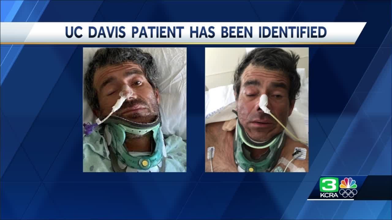 UC Davis patient has been identified