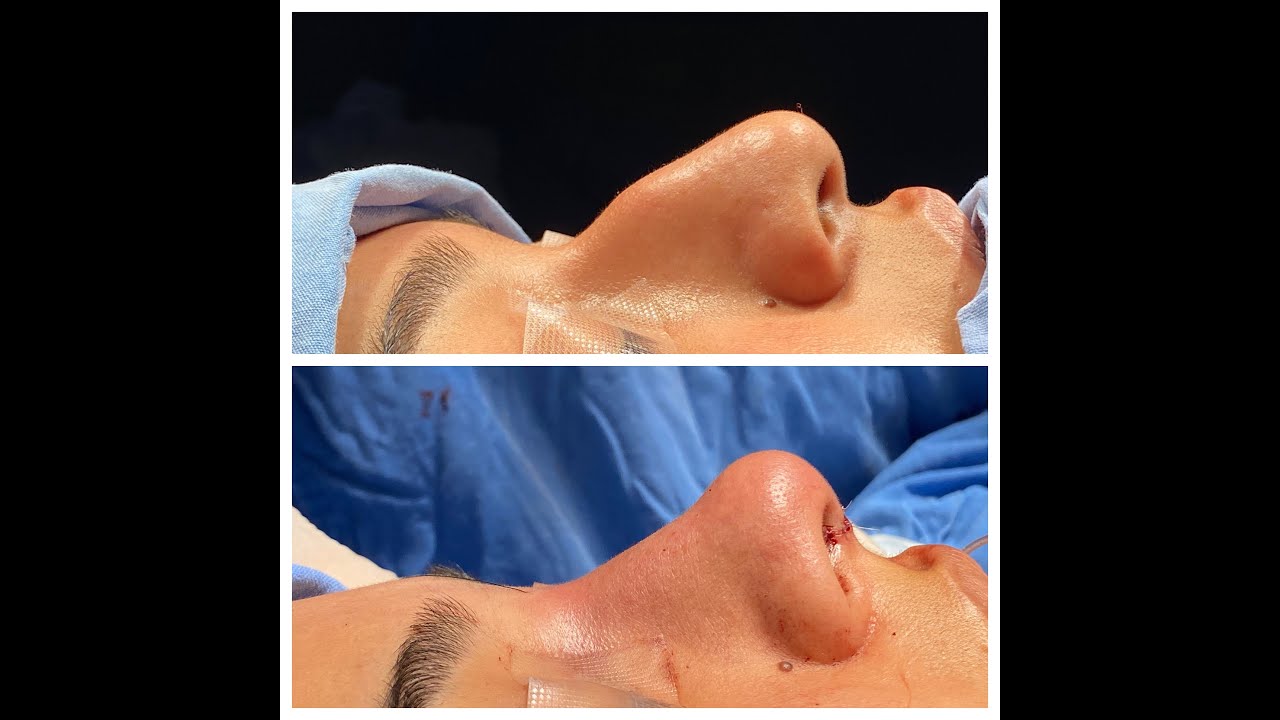 Alejandro Jimenez Garcia-56