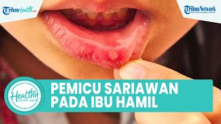 Perubahan Hormon Selama Kehamilan Bisa Picu Munculnya Sariawan, Begini Penjelasannya