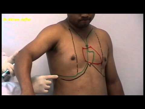 Surface anatomy of the thorax + Anki flashcards