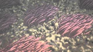 Product video: Provox XtraFlow HME