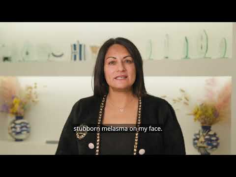 Patient testimonial for melasma treatment at Dr Ana • The Skin Clinic