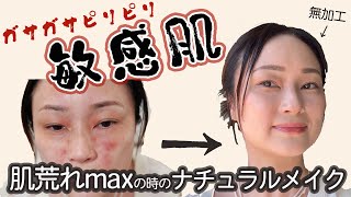 ホントはメイクなんかしないでベッドで寝てたい、そんな日の揺らぎ肌メイク＆コスメ紹介：ながら話ing in LA(308)