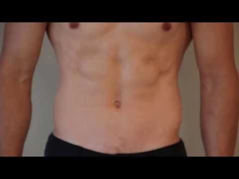 Muscle Actions: Rectus Abdominis
