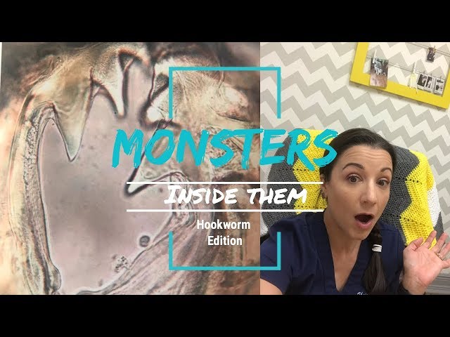 Monsters Inside Them?