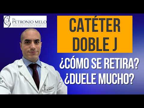 Catéter Doble J - ¿Cómo se retira? ¿Duele mucho?