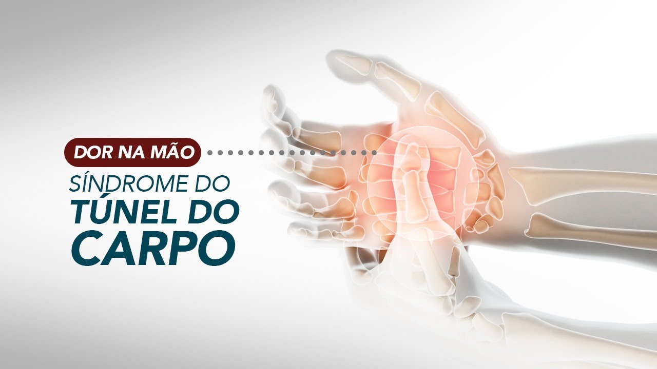 Síndrome do Túnel do Carpo