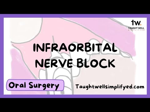 Infraorbital Nerve Block Technique | Tips for finding the infraorbital foramen