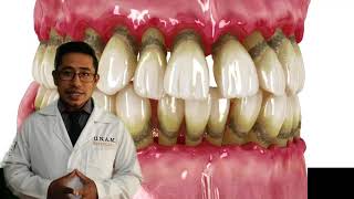 ¿Por qué se mueven mis dientes