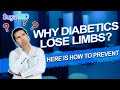 Do DIABETICS REALLY LOSE LIMBS or GET AMPUTATED OFTEN?