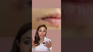 How To Get Rid Of Angular Cheilitis For Good! #dermatologist