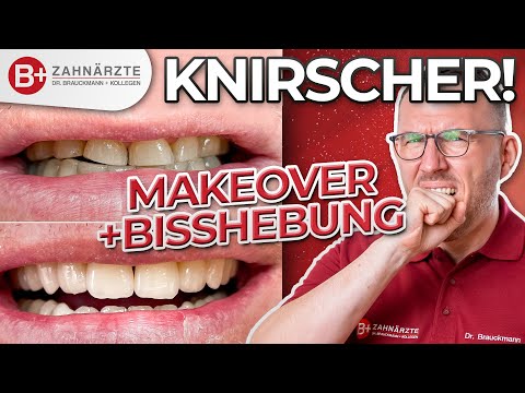 Zähneknirschen - Das kannst Du als Knirscher tun! Patientenfall mit Kronen und Bisshebung gelöst!