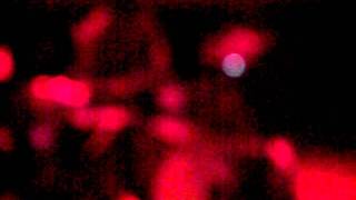 Television by Jack&#39;s Mannequin (Live)