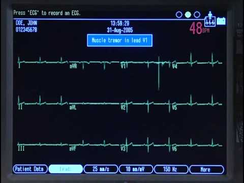 Mac 5500 training video (part 2)