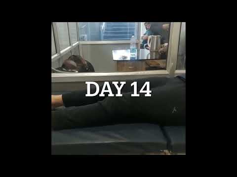 Wow! Young brave girls journey after her ACL Repair surgery by Olympic ACL surgeon Dr Manit Arora