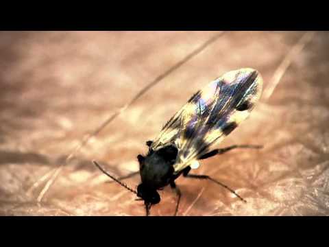 Midge bites through presenters arm - The Secret Life of Midges - BBC