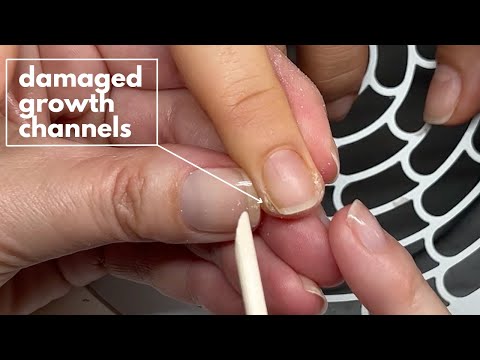 Hard skin on the side of the nails | Damaged growth channels [Watch Me Work]