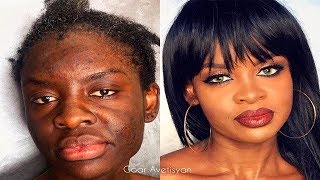 Russian makeup artist Goar Avetisyan gave a woman with a rare skin condition a makeover.