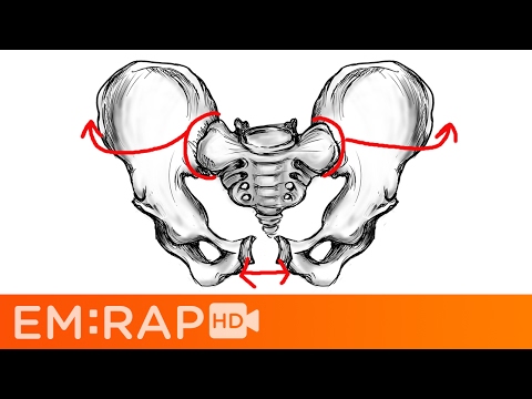 Bad Pelvic Fractures
