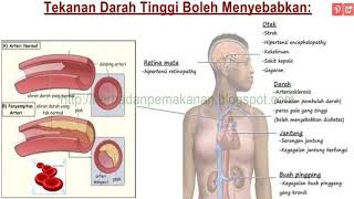 Download lagu RUQYAH YANG DAPAT MERAWAT PENYAKIT DARAH TINGGI mp3 Download lagu RUQYAH YANG DAPAT MERAWAT PENYAKIT DARAH TINGGI mp3