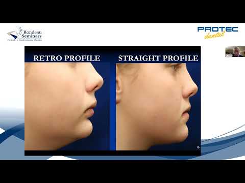 WEBINAR - Early Interceptive Orthodontic Treatment