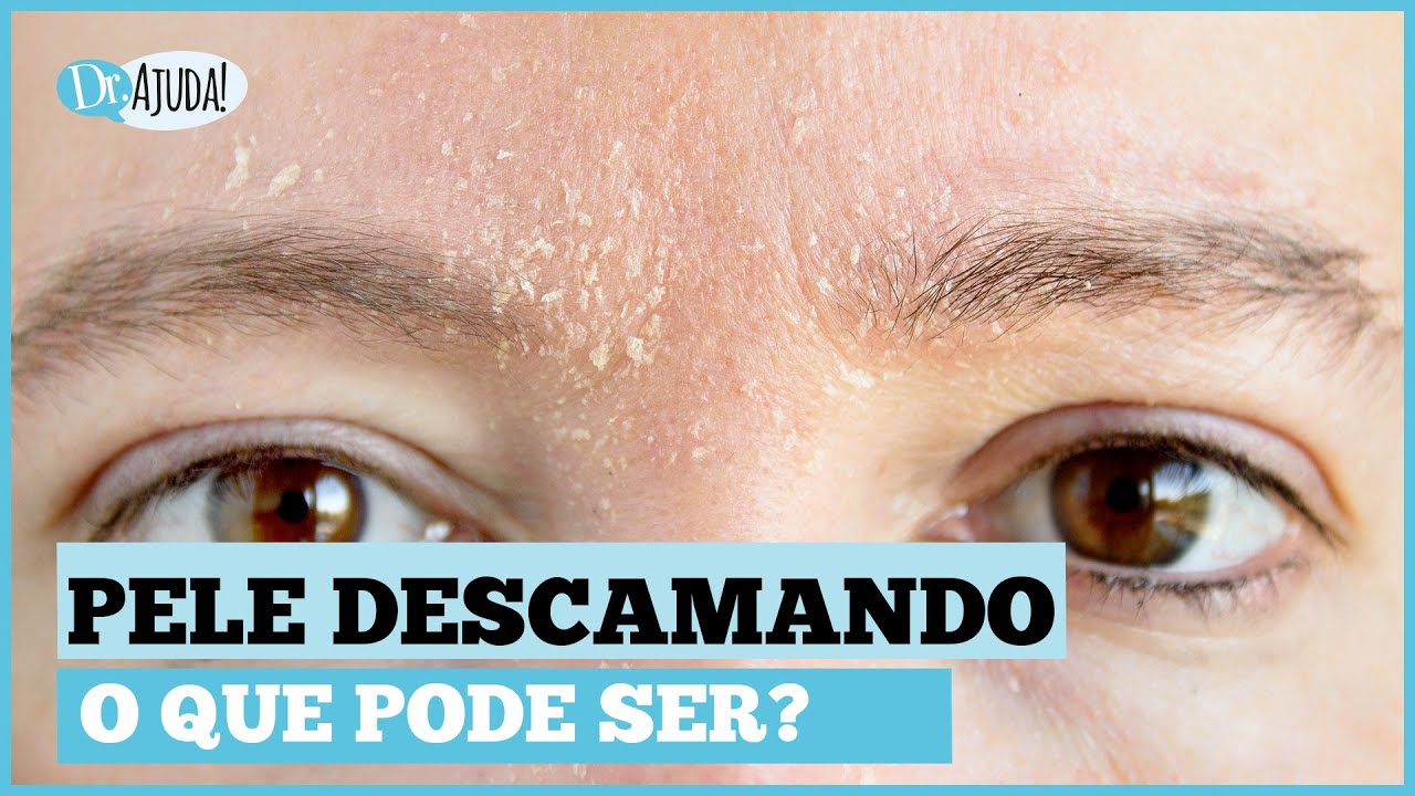 PELE DESCAMANDO: CAUSAS, SINTOMAS E O QUE FAZER?