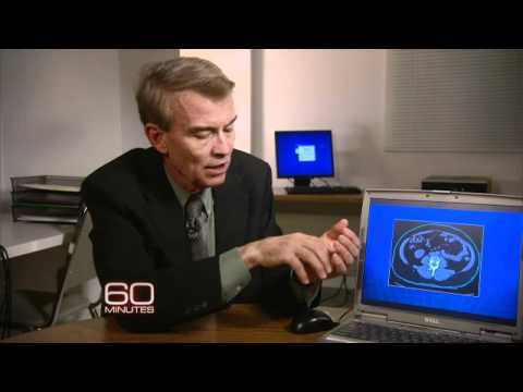 How fructose builds belly fat