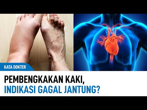 , title : 'Benarkah Kaki Bengkak Jadi Indikasi Gagal Jantung? | Kata Dokter'